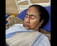 ममता बनर्जी के माथे पर लगी चोट
